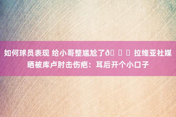 如何球员表现 给小哥整尴尬了😅拉维亚社媒晒被库卢肘击伤疤：耳后开个小口子