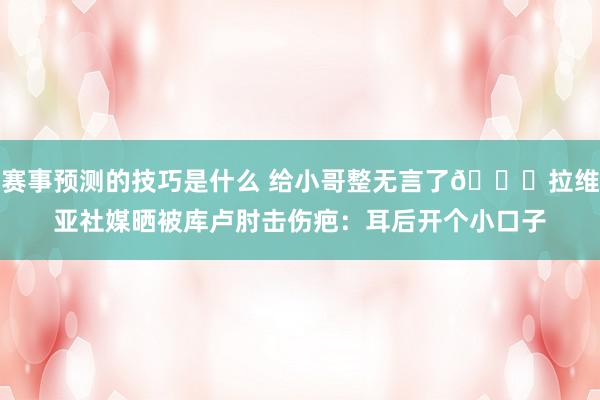 赛事预测的技巧是什么 给小哥整无言了😅拉维亚社媒晒被库卢肘击伤疤：耳后开个小口子